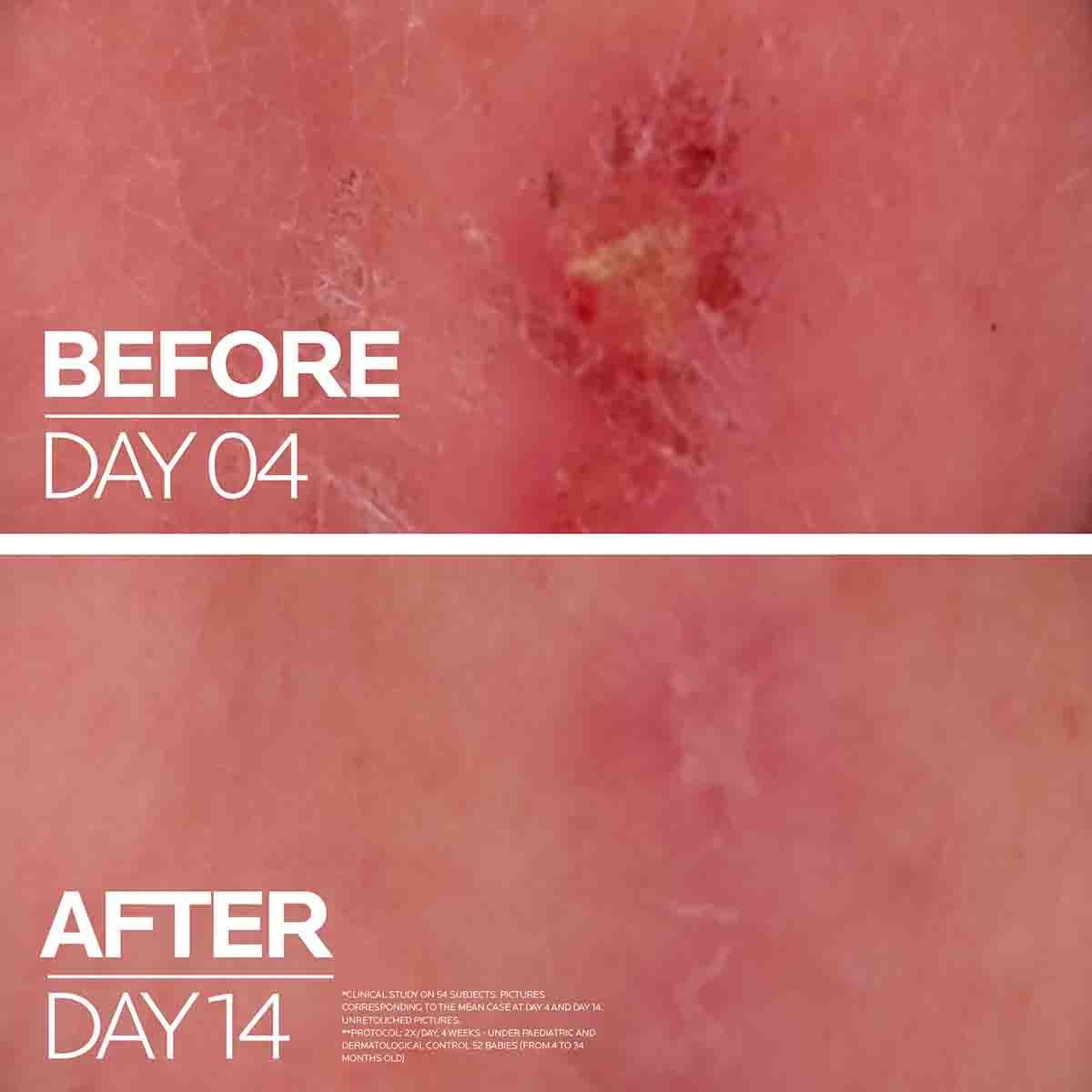 Bálsamo Reparador Multiusos La Roche-Posay Cicaplast B5+ Pantenol Madecasósido 100ml Piel Irritada