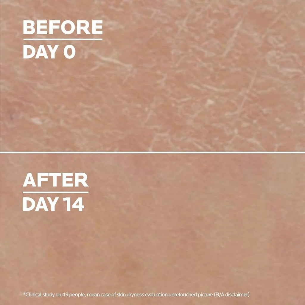 Loción Corporal Urea 10% La Roche-Posay Lipikar Lait Alantoína Manteca Karité 400ml Queratosis Pilaris