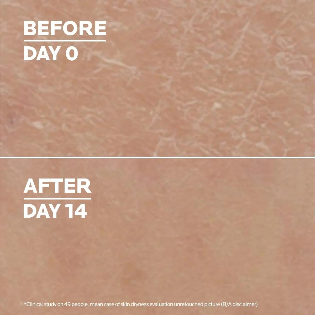 Loción Corporal Urea 10% La Roche-Posay Lipikar Lait Alantoína Manteca Karité 400ml Queratosis Pilaris